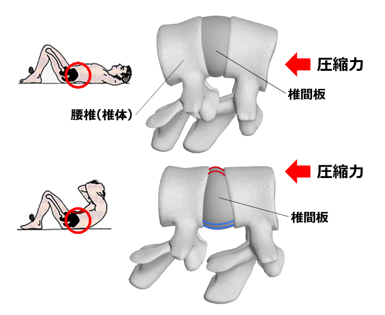 図１　腰椎の屈曲（下）に伴う圧縮力の偏り