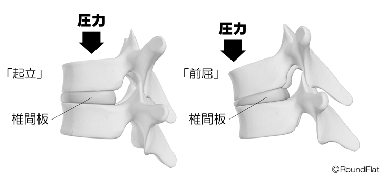 姿勢の変化に伴う椎間板に加わる圧力の変位